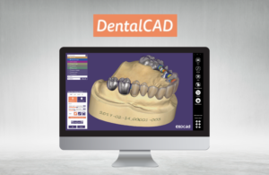 exocad – F1 Dentalsysteme GmbH, CAD/CAM Software