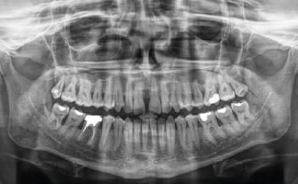 DEXIS® DTX Studio Clinic Software – F1 Dentalsysteme GmbH, CAD/CAM, Fräsen & 3D-Druck