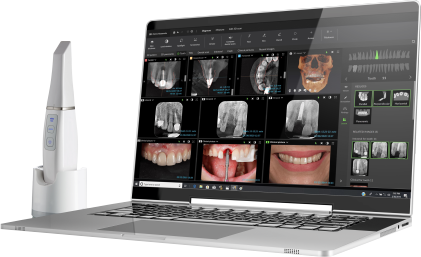DTX Studio Clinic – F1 Dentalsysteme GmbH, CAD/CAM Software