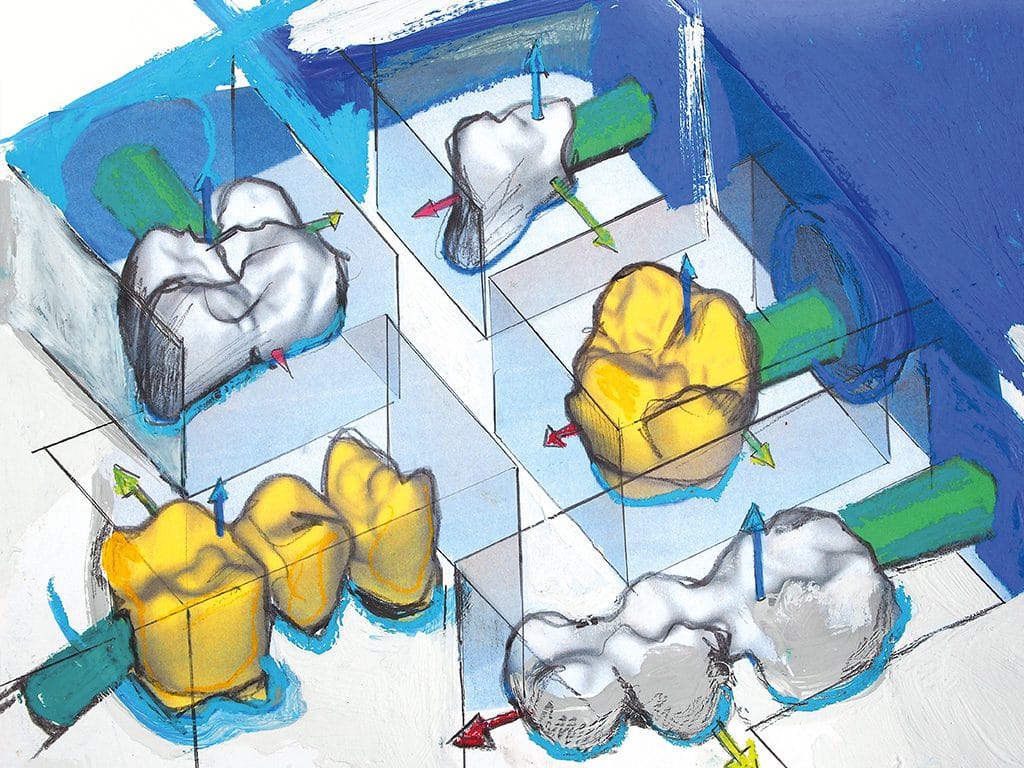 hyperDENT® Practicelab – FOLLOW-ME! TECHNOLOGY, CAD/CAM Software