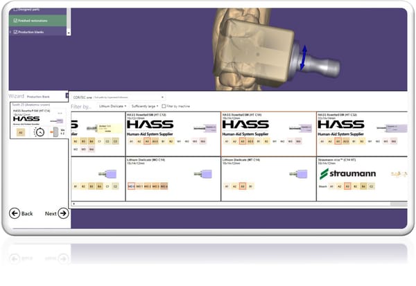hyperDENT exocad Connect