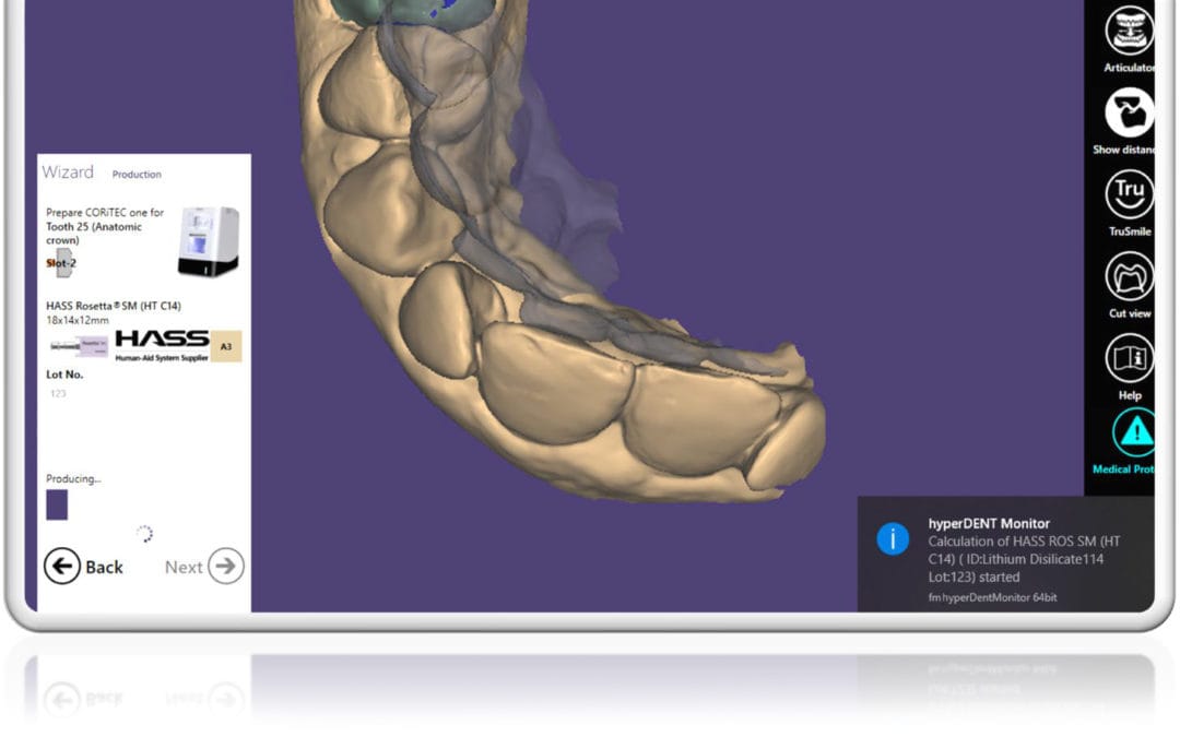 hyperDENT exocad Connect – FOLLOW-ME! TECHNOLOGY, CAD/CAM Software