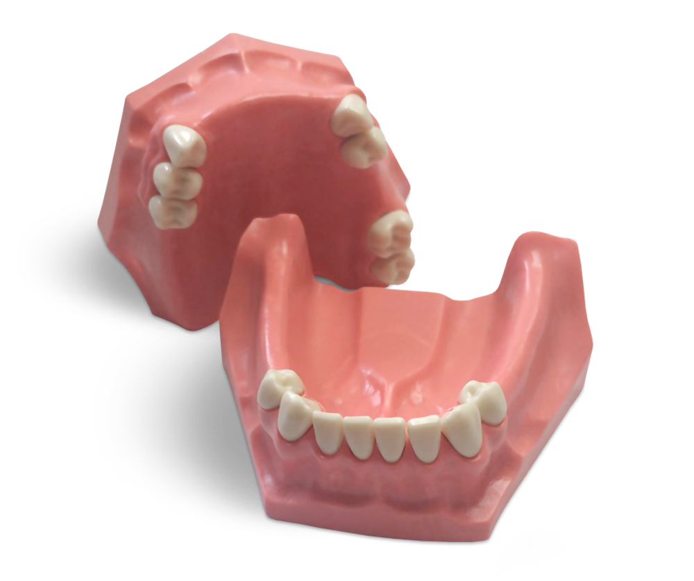 Modell für partielle Zahnerhaltung – GF Dental di Ficuciello Antonino, Die & Model Materials