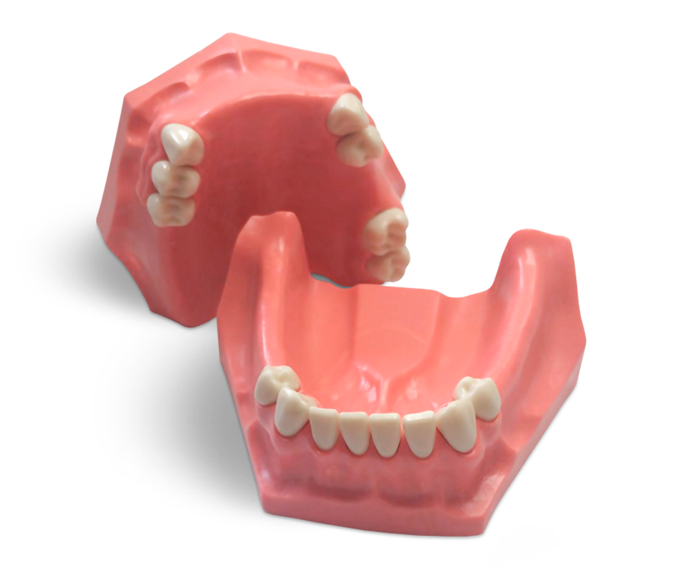 Modello per conservativa parziale – GF Dental di Ficuciello Antonino, Gypsum Additives, Die Hardeners and Plaster Removers