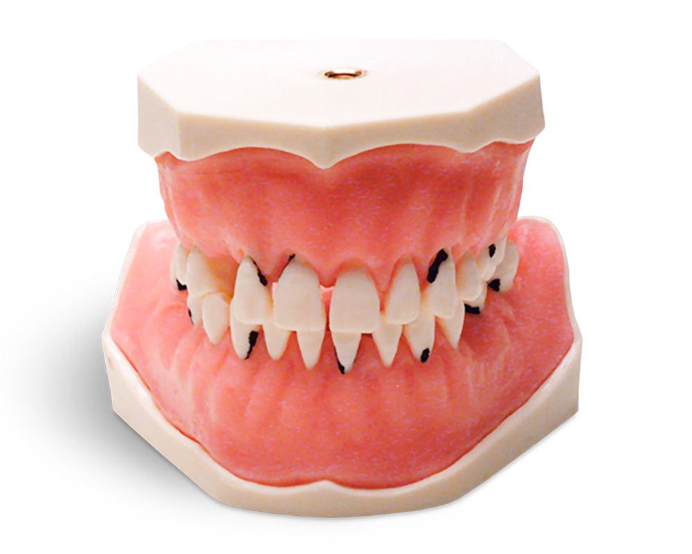 E05 – Parodontologisches Modell mit festsitzenden Zähnen – GF Dental di Ficuciello Antonino