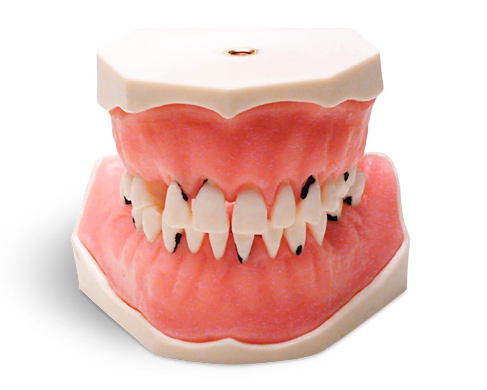 E05 - Modèle parodontal avec dents fixes – GF Dental di Ficuciello Antonino, Other Laboratory Equipment (Scales, Water Baths, Plaster Traps, Microscopes)