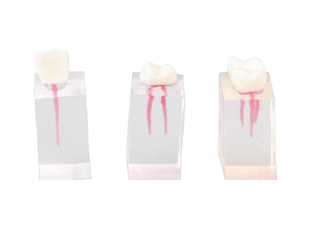 E08/C - Jeu de 3 parallélépipèdes pour exercices d'endodontie simples – GF Dental di Ficuciello Antonino, Demonstration Models