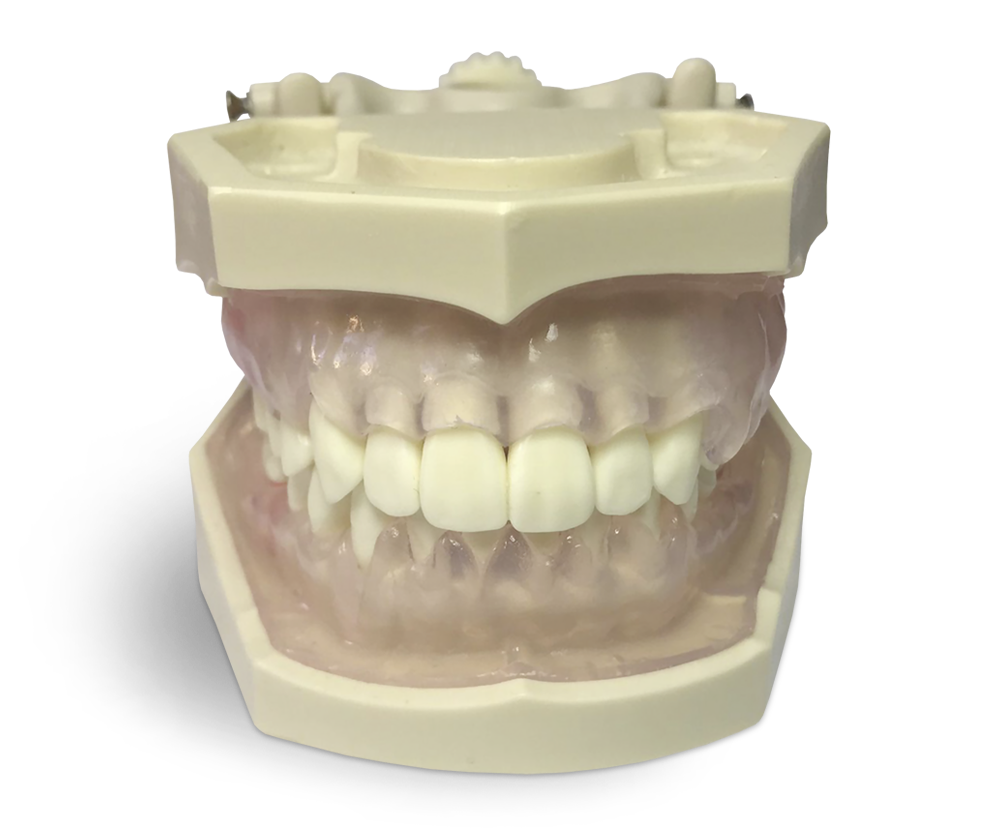 E11GP Übungsmodell für Dentalhygienikerinnen – GF Dental di Ficuciello Antonino, Die & Model Materials