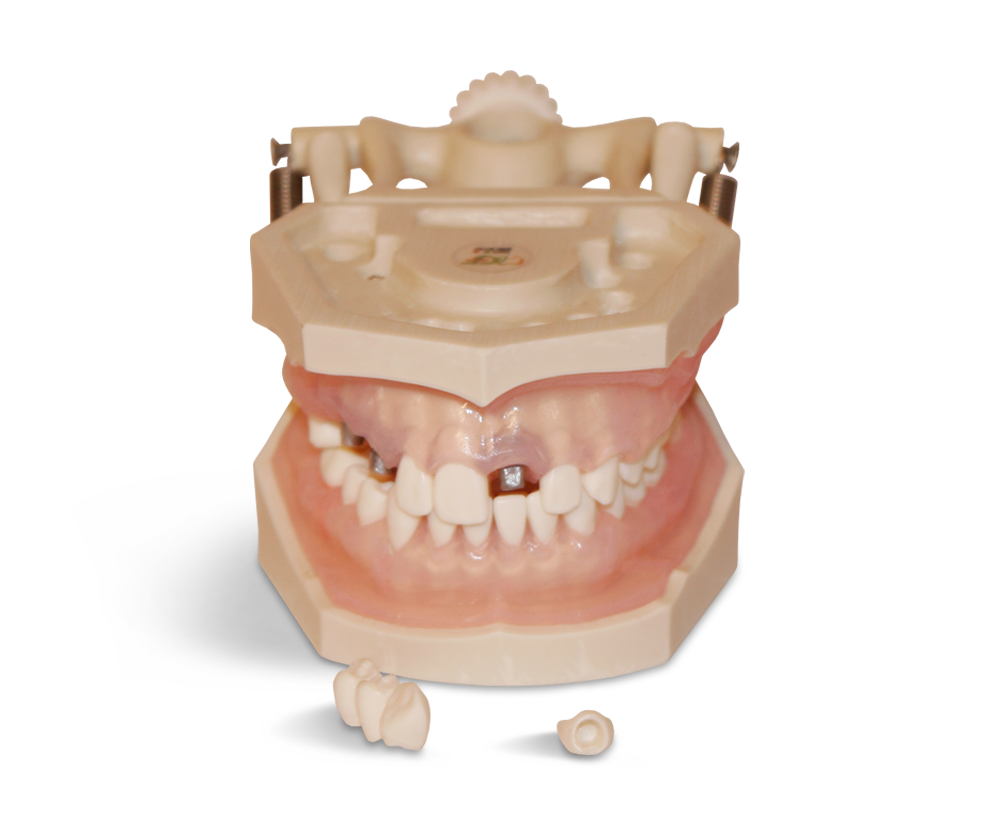 E12N - Modèle pour exercices d'hygiène bucco-dentaire – GF Dental di Ficuciello Antonino, Gypsum Additives, Die Hardeners and Plaster Removers
