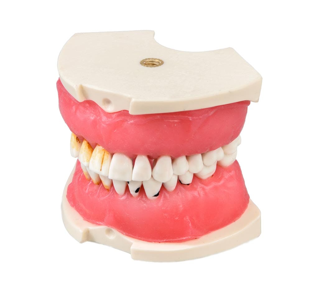 E26 – Modell mit parodontopathischem Zahnfleisch – GF Dental di Ficuciello Antonino, Gipszusätze, Stumpflacke und Gipslöser