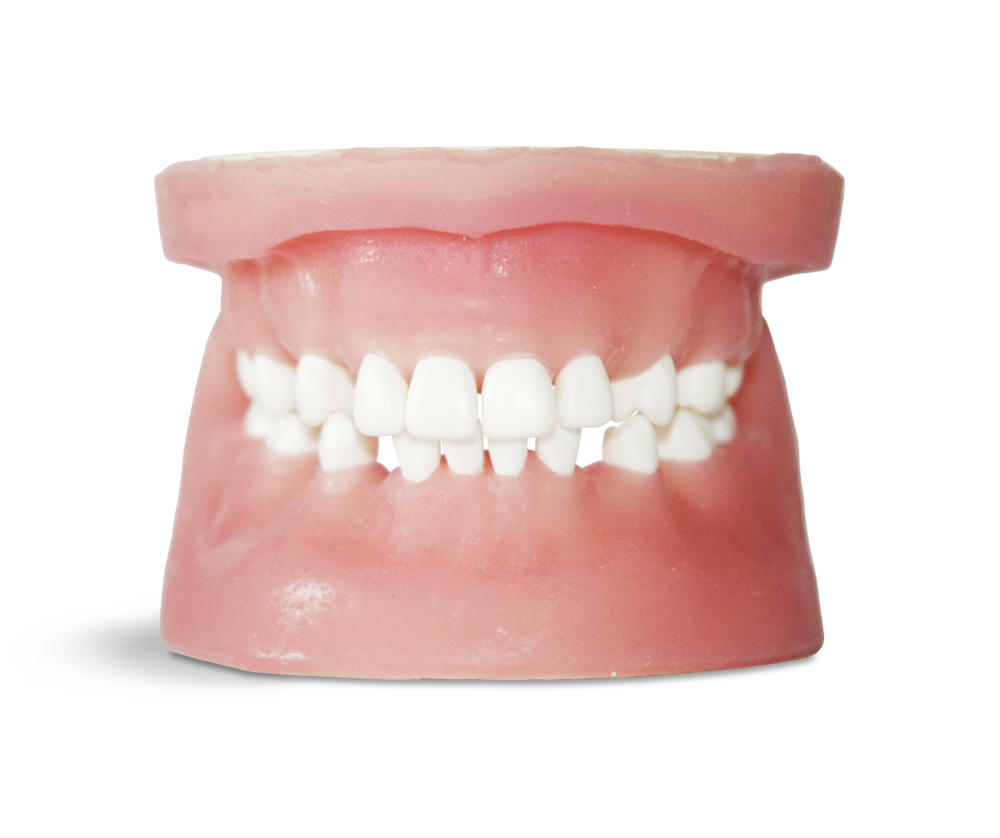 E34 – Chirurgisches Übungsmodell aus Kunststoff – GF Dental di Ficuciello Antonino, Gipszusätze, Stumpflacke und Gipslöser