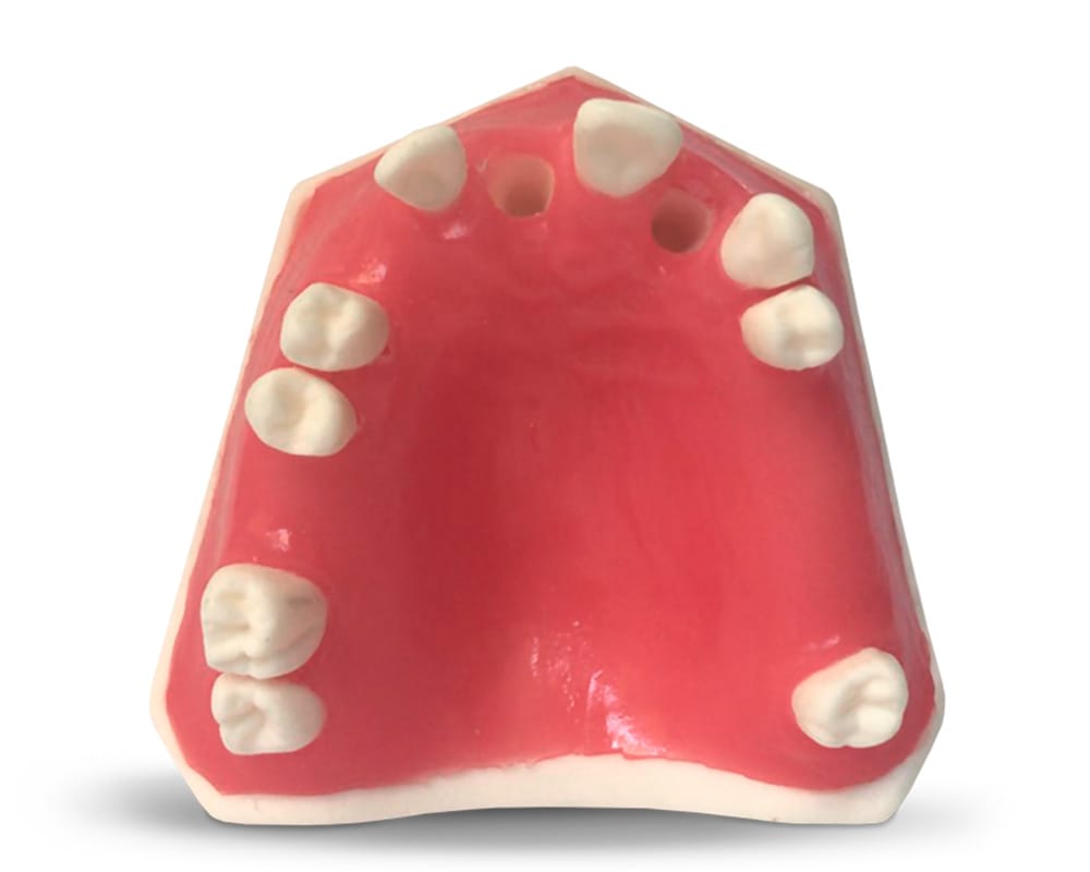 E37 – Kiefermodell aus Kunststoff – GF Dental di Ficuciello Antonino, Gipszusätze, Stumpflacke und Gipslöser
