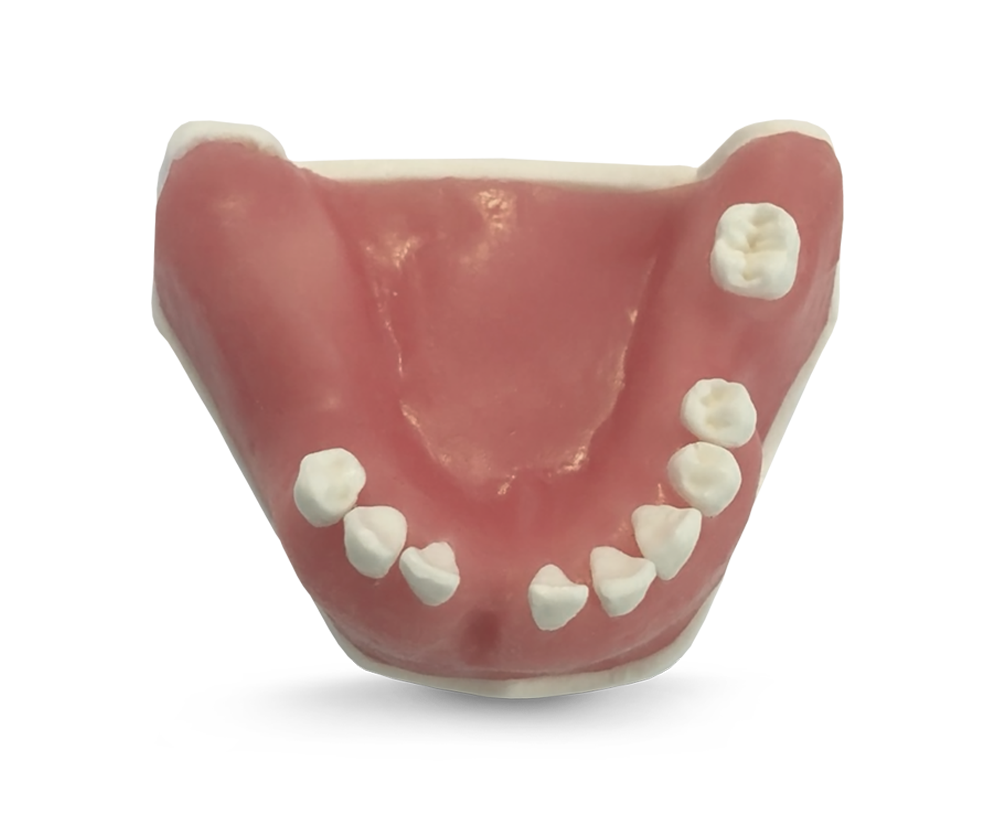 E39 – Unterkiefermodell aus Kunststoff – GF Dental di Ficuciello Antonino, Gipszusätze, Stumpflacke und Gipslöser