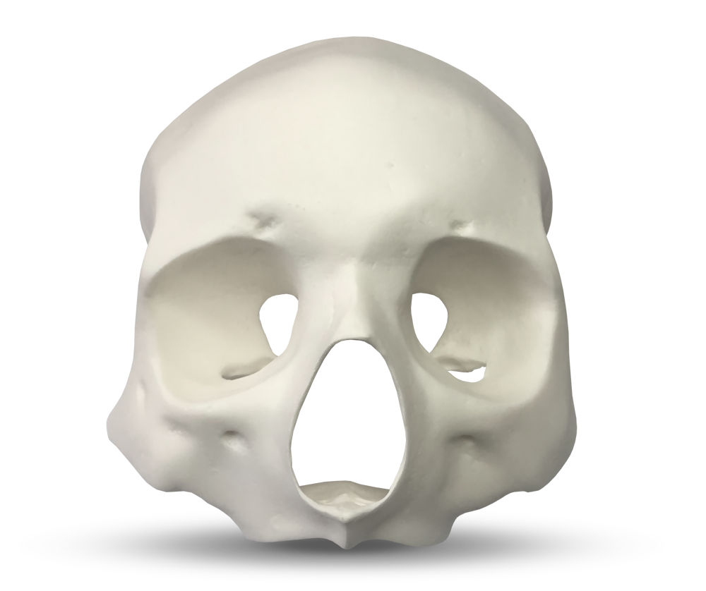 E51 – Anatomisches Gesichtsmodell zur Darstellung der Knochendichte – GF Dental di Ficuciello Antonino, Gipszusätze, Stumpflacke und Gipslöser