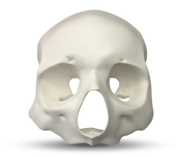 E51 – Anatomisches Gesichtsmodell zur Darstellung der Knochendichte