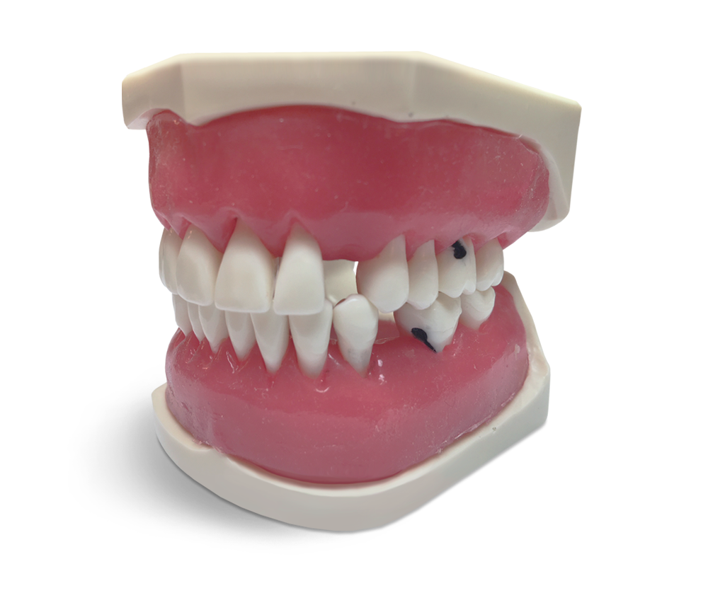 E56 - Modèle parodontal avec dents fixées par vis – GF Dental di Ficuciello Antonino, Gypsum Additives, Die Hardeners and Plaster Removers