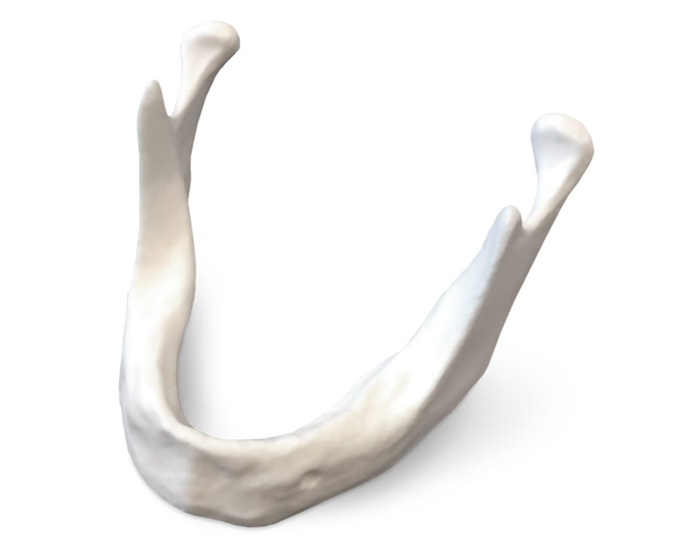 E81 – Unterkiefermodell mit schmalem Alveolarkamm – GF Dental di Ficuciello Antonino, Gipszusätze, Stumpflacke und Gipslöser