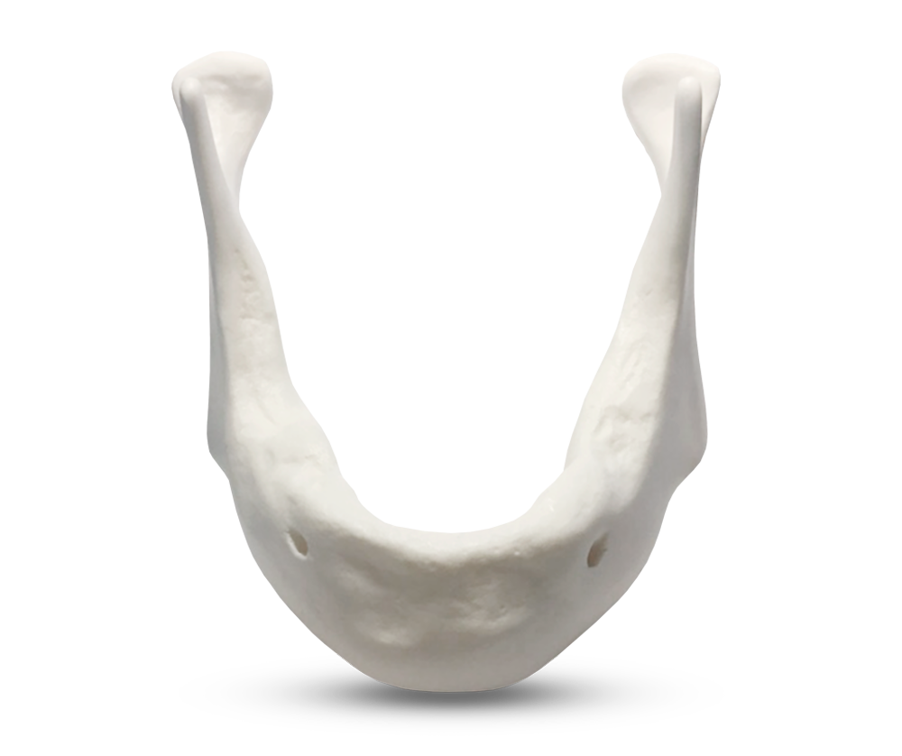 E81/L – Unterkiefermodell aus synthetischem Knochenmaterial – GF Dental di Ficuciello Antonino, Gipszusätze, Stumpflacke und Gipslöser