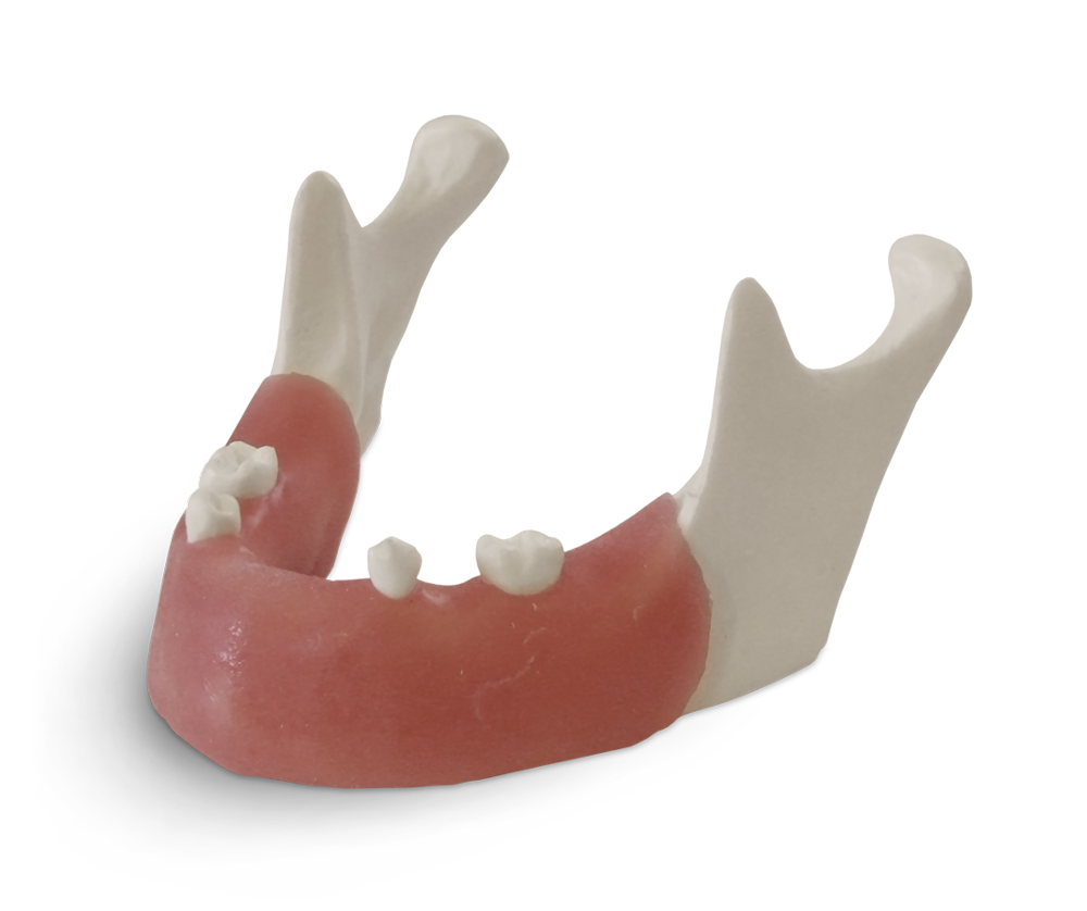 E82 – Unterkiefermodell für implantologische Übungen – GF Dental di Ficuciello Antonino, Gipszusätze, Stumpflacke und Gipslöser