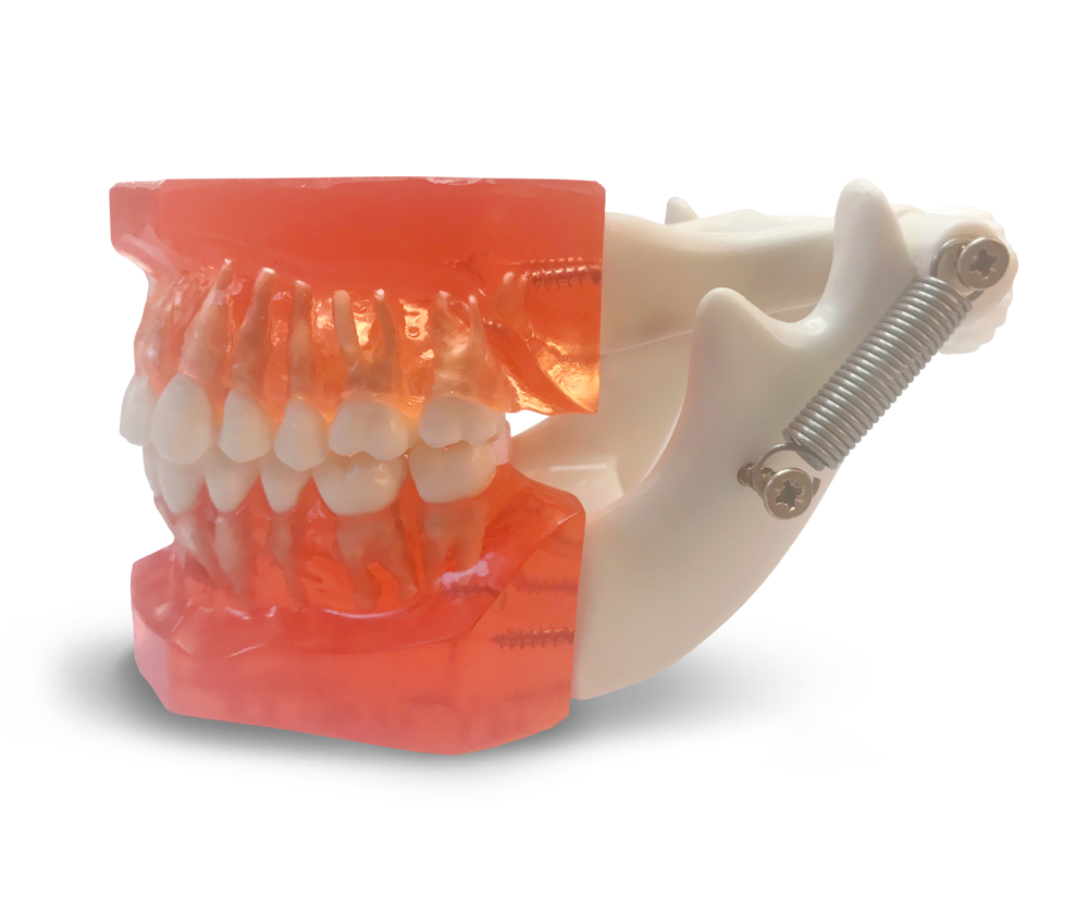 ETR1 - Model for practice of mini orthodontic implants – GF Dental di Ficuciello Antonino, Mini Implants