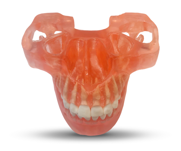 ETR2 - Maxillaire et mandibule pour formation aux mini-implants orthodontiques