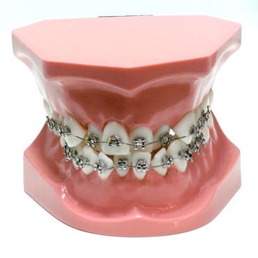 ORB02 - Modèle orthodontique d'encombrement frontal – GF Dental di Ficuciello Antonino, Other Laboratory Equipment (Scales, Water Baths, Plaster Traps, Microscopes)