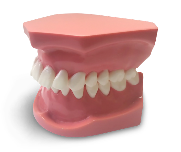 ORB03 - Modèle orthodontique Classe 1 Division 2