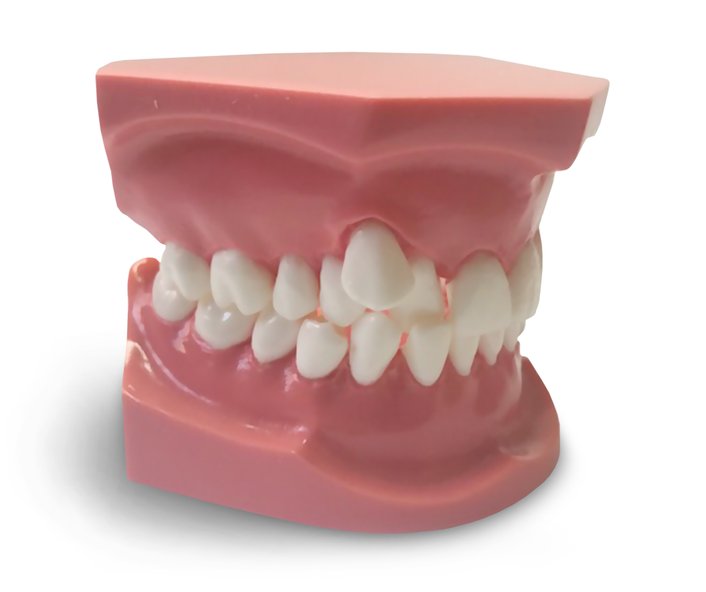 ORB05 - Modèle orthodontique avec éruption canine ectopique – GF Dental di Ficuciello Antonino, Other Laboratory Equipment (Scales, Water Baths, Plaster Traps, Microscopes)
