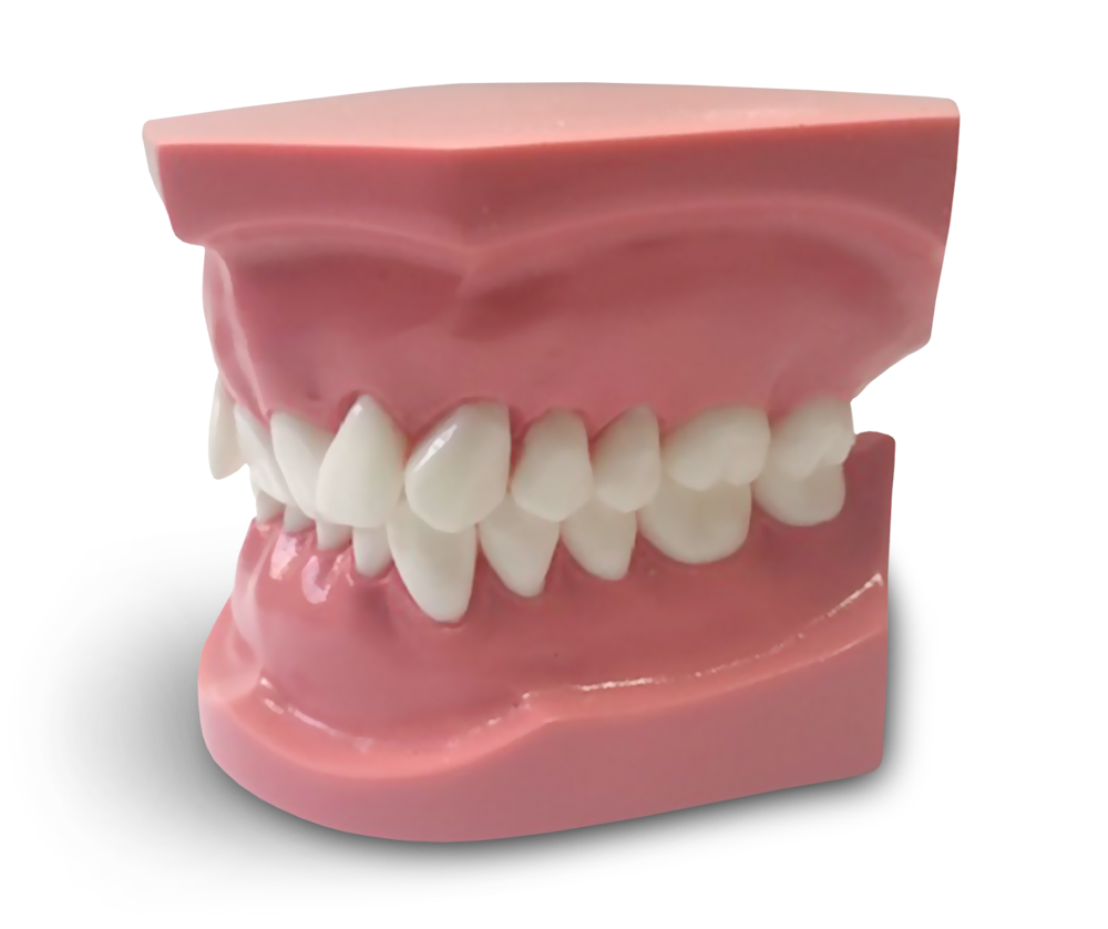 ORB06 - Modèle orthodontique classe 2 division 2 – GF Dental di Ficuciello Antonino, Other Laboratory Equipment (Scales, Water Baths, Plaster Traps, Microscopes)