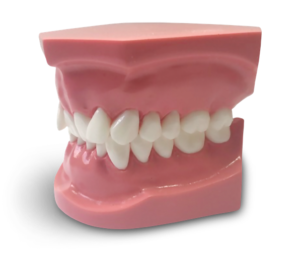 ORB06 - Modèle orthodontique classe 2 division 2
