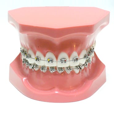 ORB01 - Orthodontic Model Class 1 – GF Dental di Ficuciello Antonino, Other Laboratory Equipment (Scales, Water Baths, Plaster Traps, Microscopes)