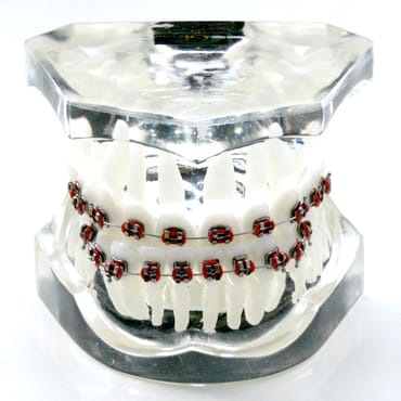 3 class orthodontic model