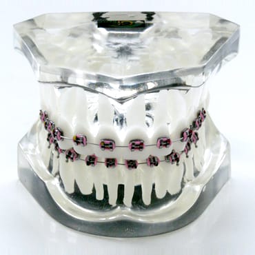 Transparent Dental Models