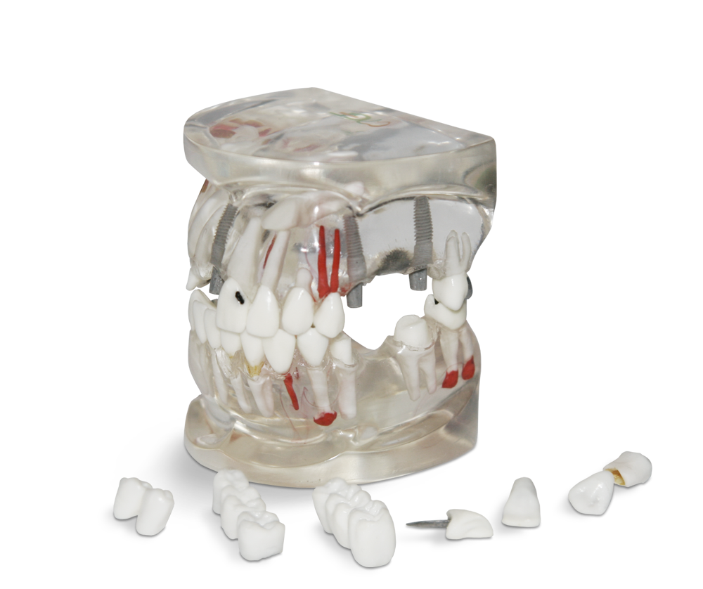 Patient doctor dialog model – GF Dental di Ficuciello Antonino, Gypsum Additives, Die Hardeners and Plaster Removers