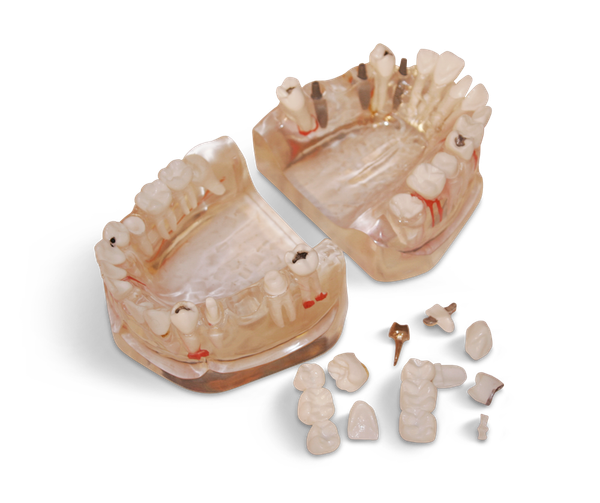 Significantly enlarged model in 3:1 scale