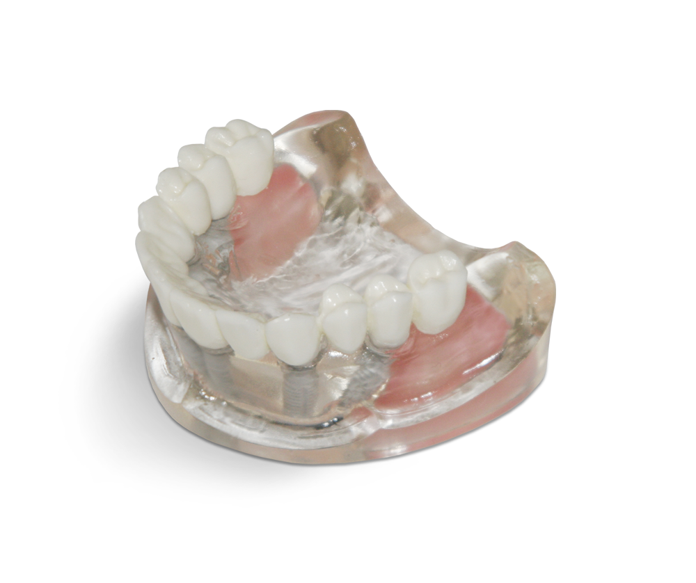 Transparent resin model with maxillary sinuses – GF Dental di Ficuciello Antonino, Gipszusätze, Stumpflacke und Gipslöser