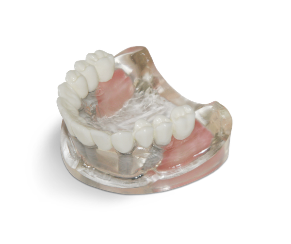 Transparent resin model with maxillary sinuses