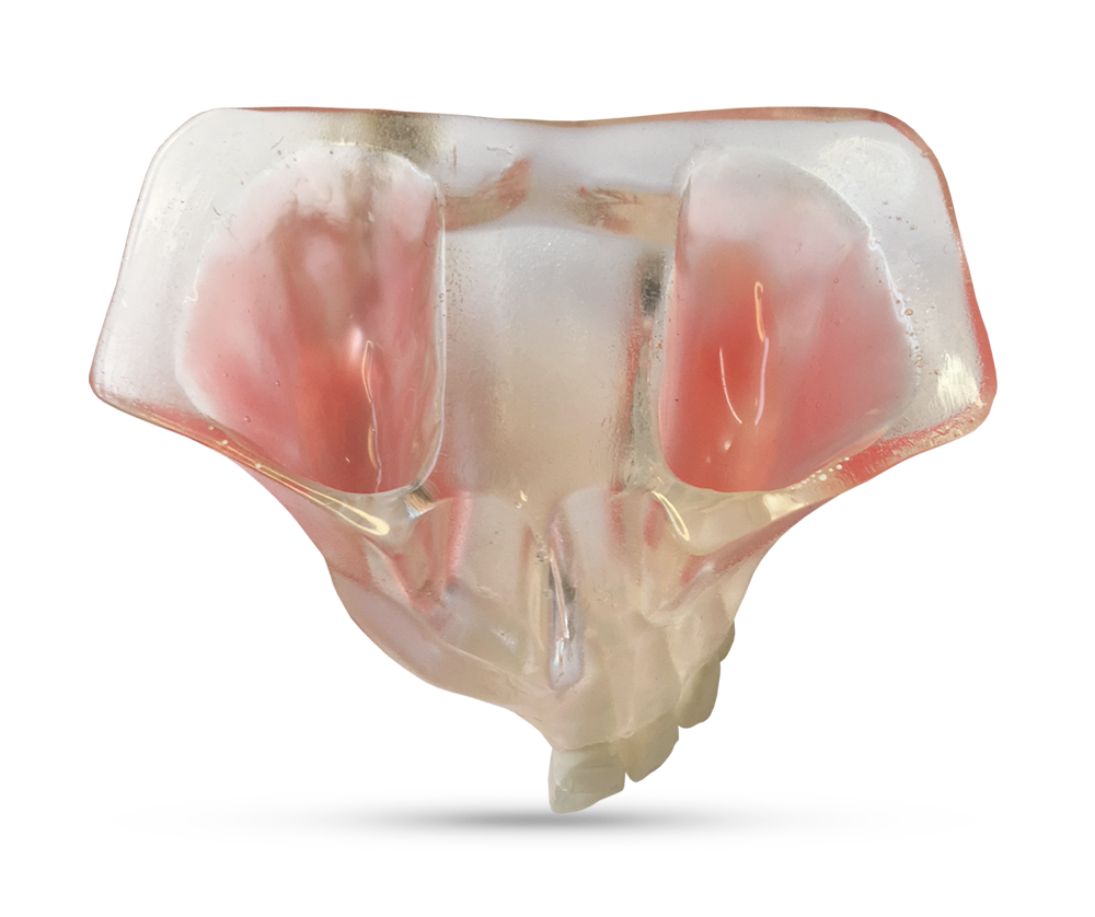 Demonstration model of jaw – GF Dental di Ficuciello Antonino, Gipszusätze, Stumpflacke und Gipslöser