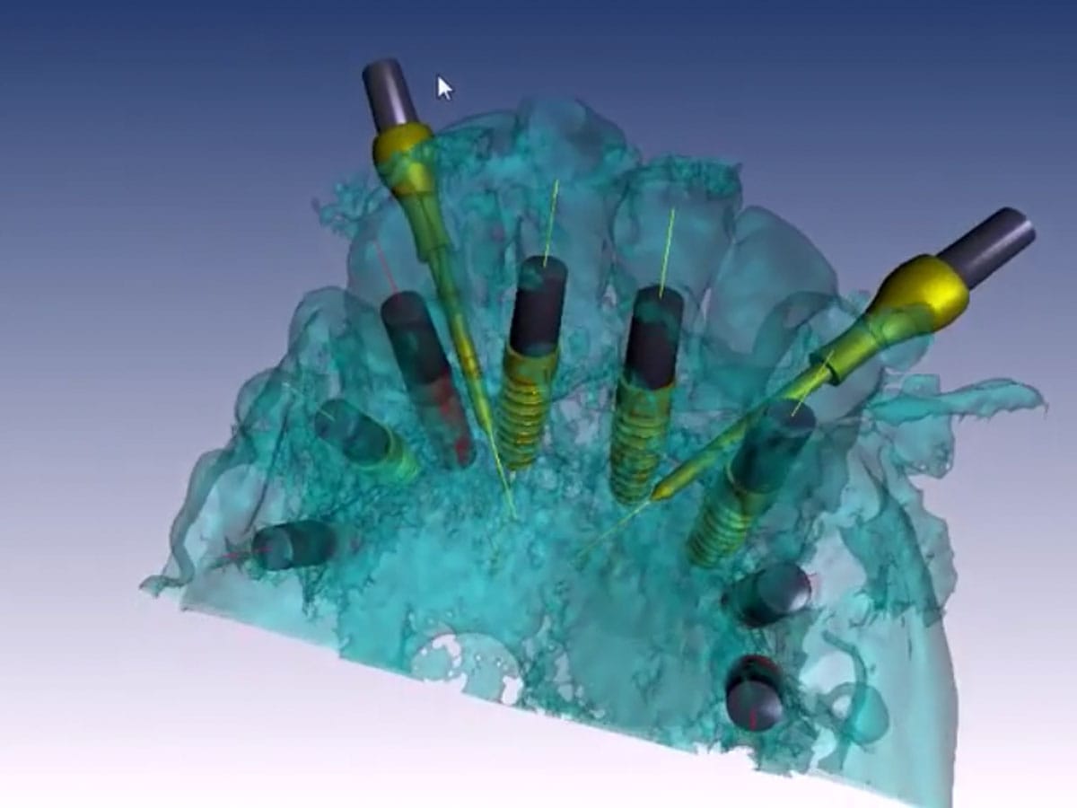 BNX 3D Guide – Ghimas S.p.A., Planungshilfen