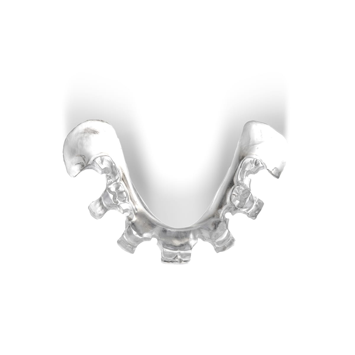 OP SCHABLONE MANDIBULA B1 ANATOMY – Dr. Thomas Bohne e. K., Implantate