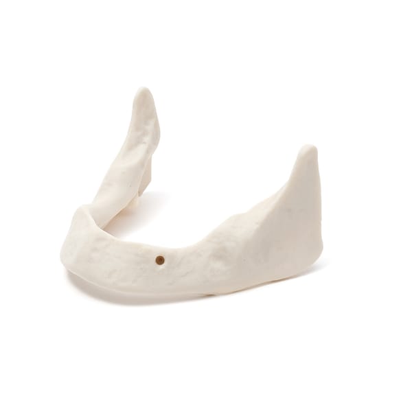 MANDIBULA B3 BONE