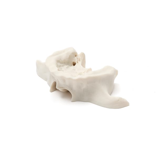 MAXILLA A1 BONE