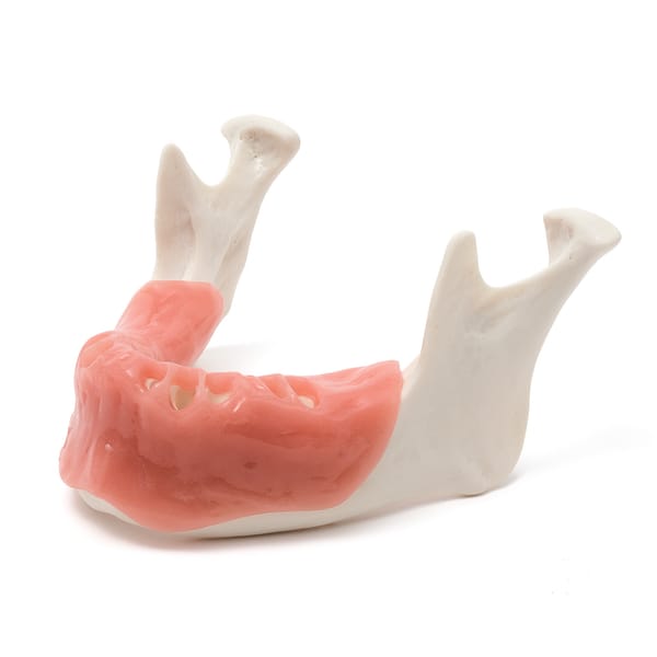 MANDIBULA A3 MUCOSA