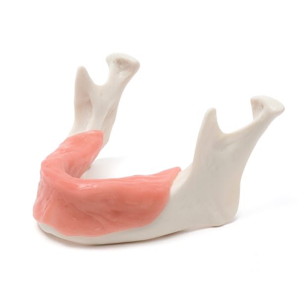 MANDIBULA A1 MUCOSA