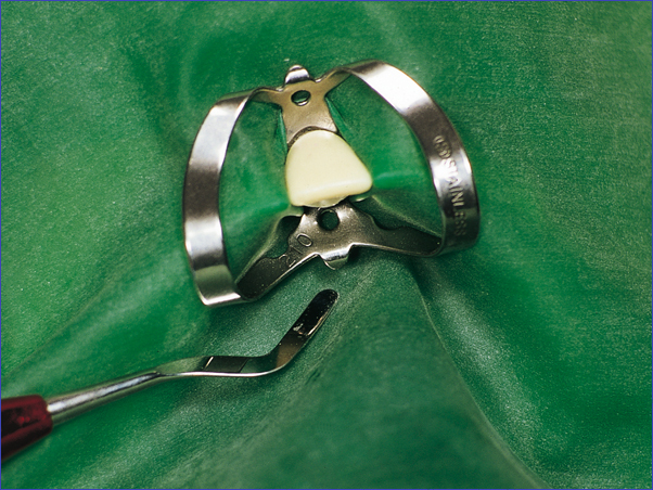 Fit-Kofferdam® Latex – Hager & Werken, Rubber Dam Systems & Accessories