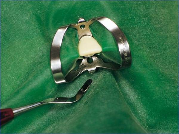 Fit-Kofferdam® Latex