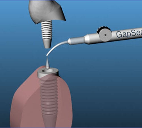 Embouts applicateurs GapSeal – Hager & Werken, Application Brushes
