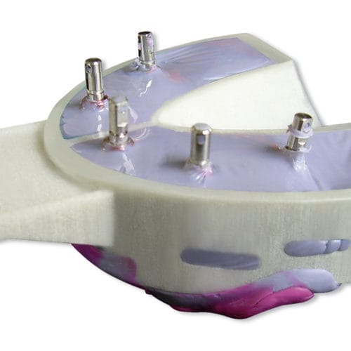 Miratray® Implant – Hager & Werken, Abdrucklöffel
