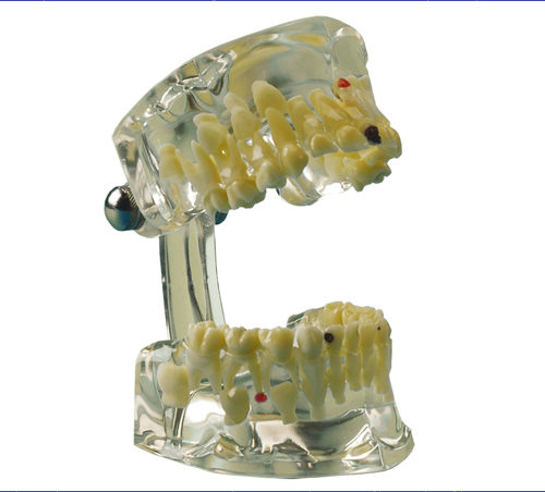 Studienmodell Transparent Kind – Hager & Werken, Die & Model Materials