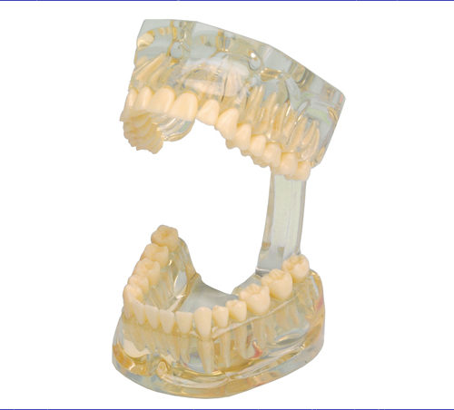 Studienmodell Transparent – Hager & Werken, Die & Model Materials